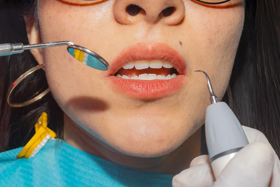 Limpieza periodontal con escariador ultrasónico